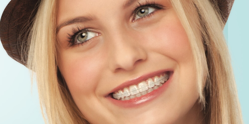 orthodontics-content-image